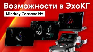 Возможности Mindray Consona N9 в эхокардиографии