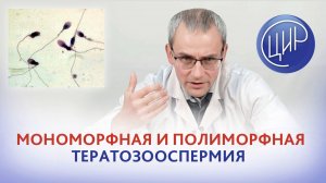Тератозооспермия: мономорфная и полиморфная тератозооспермия. Андрей Романович Живулько.