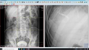 Рабочая станция врача "АрхиМед" и её функции. Часть 2. Окно просмотра изображений.