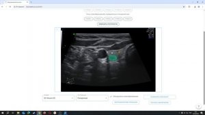 Инт ассистент врача УЗИ