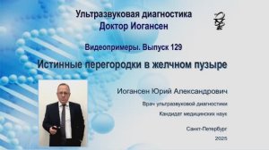УЗИ. Доктор Иогансен. Видеопримеры. Выпуск 129. Истинные перегородки в желчном пузыре.