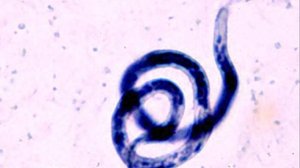 БРУГИОЗ забытая тропическая болезнь _ Морфология, Цикл, Клиника, Лечение и Профилактика БРУГИОЗА