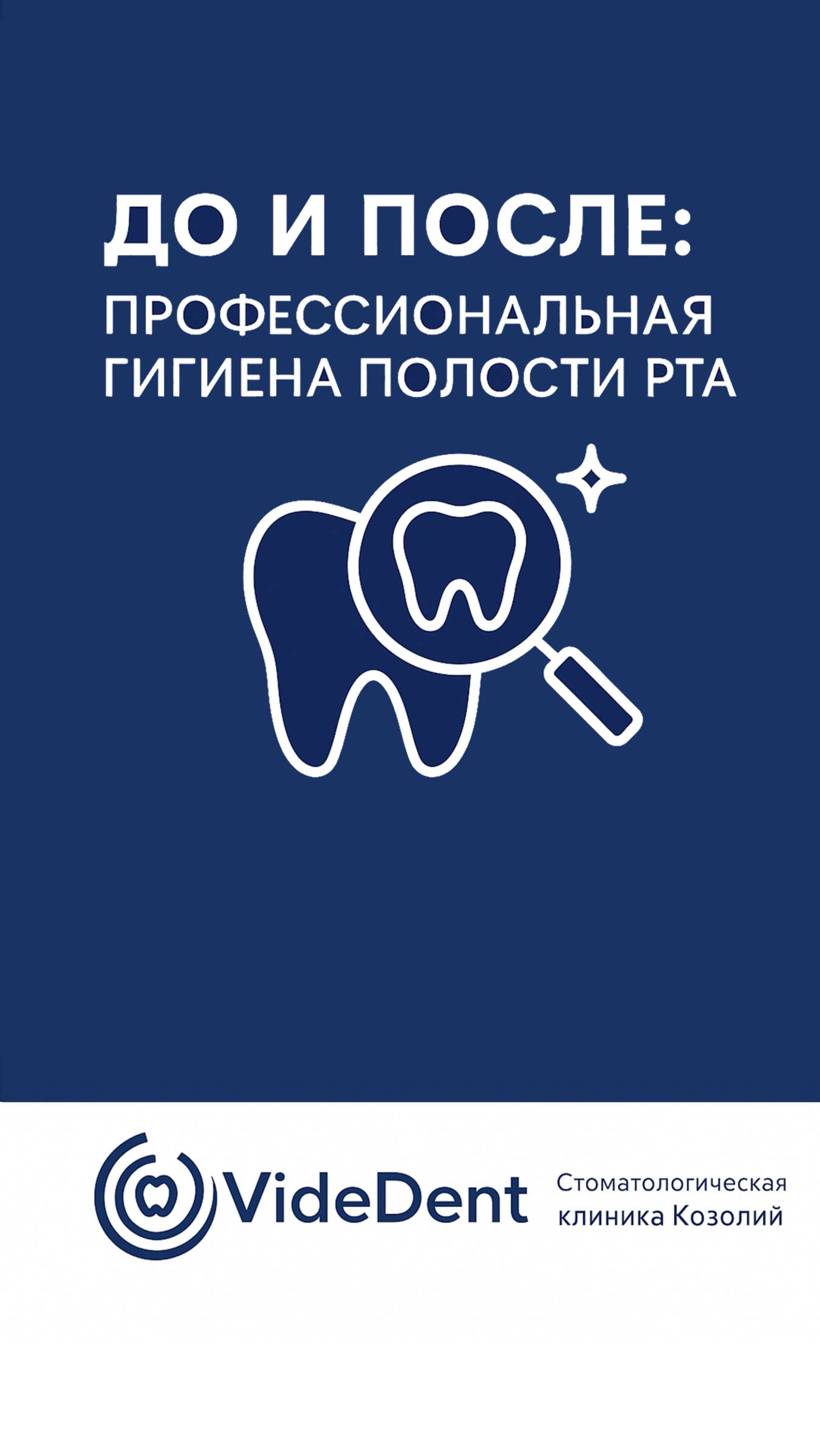 Как выглядят зубы после гигиена полости рта? #стоматология #гигиеназубов #профчистка #здоровье