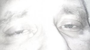 ВИДЫ АТАКСИИ (мозжечковая, сенситивная, вестибулярная, лобная, конверсионная) НЕВРОЛОГИЯ