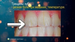 12 скрытых причин зубной боли! То, о чём не говорят стоматологи
