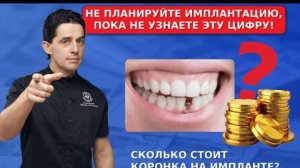 Не планируйте имплантацию, пока не узнаете, сколько стоит коронка!