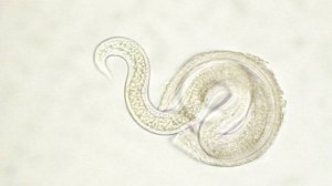 ТОКСОКАРОЗ_ Паразит, Который ЖИВЕТ В ВАС и ВАШЕЙ СЕМЬЕ _ СКРЫТАЯ ОПАСНОСТЬ ПОДСТЕРЕГАЕТ ВАС В ДОМЕ