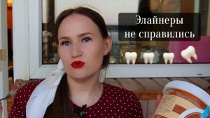 Купили керамогранит. Где стрижем ребенка. Элайнеры не повернули зуб