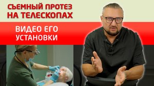 Съемные протезы на телескопах. Сняли видео установки таких протезов.