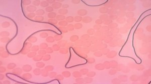 Вы можете тоннами пить витамины, но если у вас густая кровь, то результата не будет.Путь к здоровью