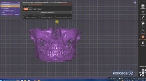 Перевод КТ в STL в EXOCAD