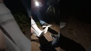 мамин друг упал в люк сломал себе две кости в ноге