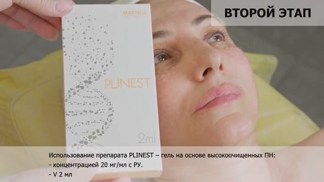 Комбинированный морфотип старения Full face trio смотреть онлайн