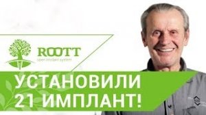 • Установка 21 импланта за 4 дня, отзыв пациента о процедуре имплантации и протезирования в ROOTT