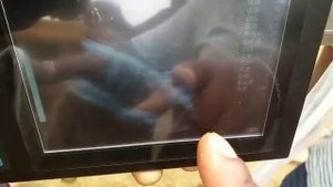 Ультразвуковой аппарат BU303 B-типа, подключенный к конвексному датчику 3,5 МГц, для проверки камней