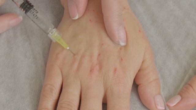 Биорепарация рук смотреть онлайн