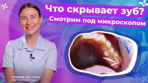 Глубокое лечение зуба под микроскопом