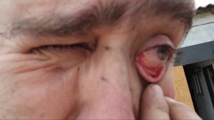 Бензопила не заводится плавают обороты, подсос воздух