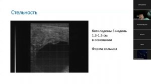 УЗИ диагностика КРС  Патология, физиология, определен?