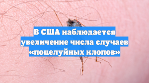 В США наблюдается увеличение числа случаев «поцелуйных клопов»