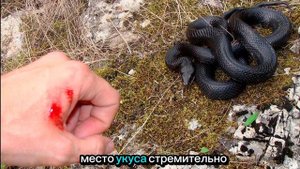 Укус ЗМЕИ.Чей яд опасный? Виды ядовитых змей!Первая по?