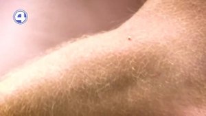 Лечение укусами пчёл | Испытано на себе с Анастасией З?