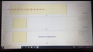 Электрокардиомиография при физических нагрузках