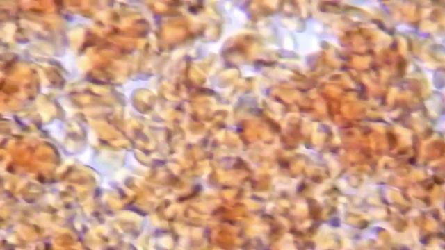 Разжижение крови, кора ивы влияние на кровь - часть2 смотреть онлайн