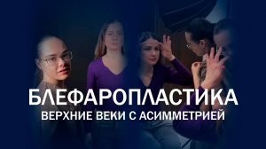 Хирургия век и выравнивание асимметрии взгляда