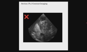 Основы УЗИ контрастная гармоника, лекция для врачей УЗИ (сон)