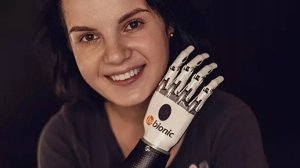 Культя Крукенберга