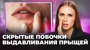 Привычка, которая испортит кожу навсегда! Реальные последствия выдавливания прыщей