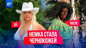 23 операции ради новой жизни: как немка решила стать африканкой