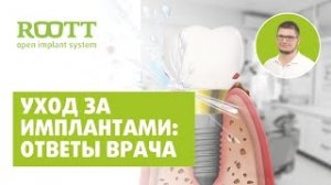 Уход за несъемными зубными протезами зубов. Как ухаживать за имплантами зубов?