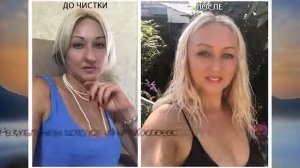 ЧИСТКИ: ДО И ПОСЛЕ