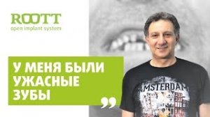 Отзыв М. Авадяева по установке имплантов в клинике имплантации зубов ROOTT в Москве