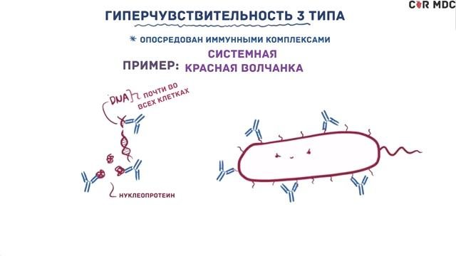 Гиперчувствительность аллергия 3 типа (иммунокомплексный)