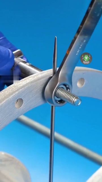 Как работает аппарат Илизарова