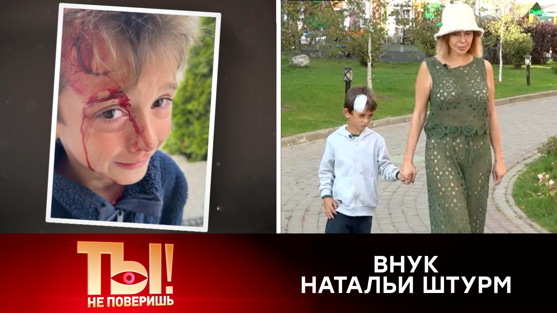Наталья Штурм требует 100тысяч рублей за разбитую камнем голову внука | Ты не поверишь!