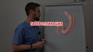 Гастропликация. Что это такое?