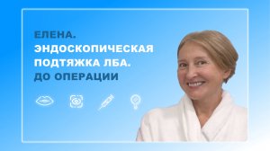 Елена. Эндоскопическая подтяжка лба. До операции