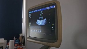 Брошенная после трагедии. В чем причина ее страданий? | Агата