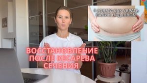 Как сделать живот плоским после кесарева сечения