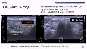 34 Калиниские чтения СЕКЦИЯ 1.1. «ДИАГНОСТИКА ХИРУРГИЧЕСКИХ ЗАБОЛЕВАНИЙ ЩИТОВИДНОЙ ЖЕЛЕЗЫ»