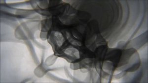 Рентгеновское_тело_в_движении_-_йога_с_гибридной_медицинской_анимацией