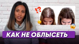 Если выпадают волосы, смотреть обязательно! Андрогенная, диффузная, гнёздная алопеция / Облысение