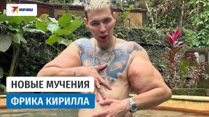 КОНЕЦ РУК-БАЗУК? РУКА фрика Терешина ПОЧЕРНЕЛА из-за уколов вазелина!