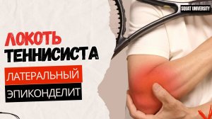 Как навсегда вылечить локоть теннисиста (без хирургического вмешательства!)