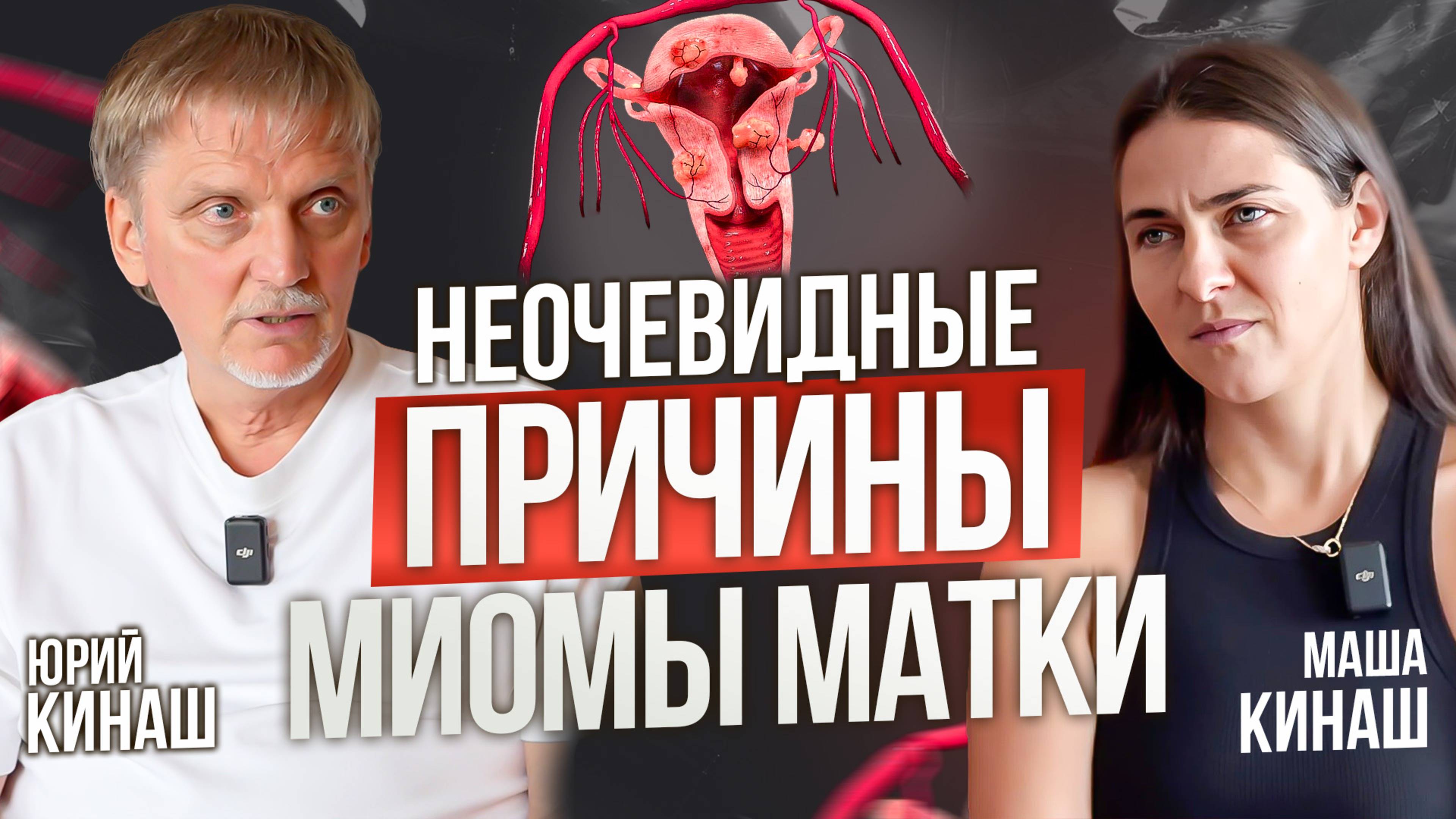 Миома матки: все причины, способы лечения, избавление без операций. Как избавиться от заболевания