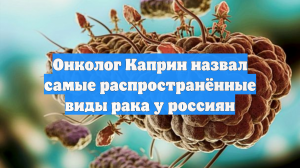Онколог Каприн назвал самые распространённые виды рака у россиян